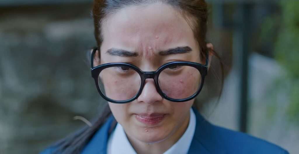 Woman with acne wearing glasses
