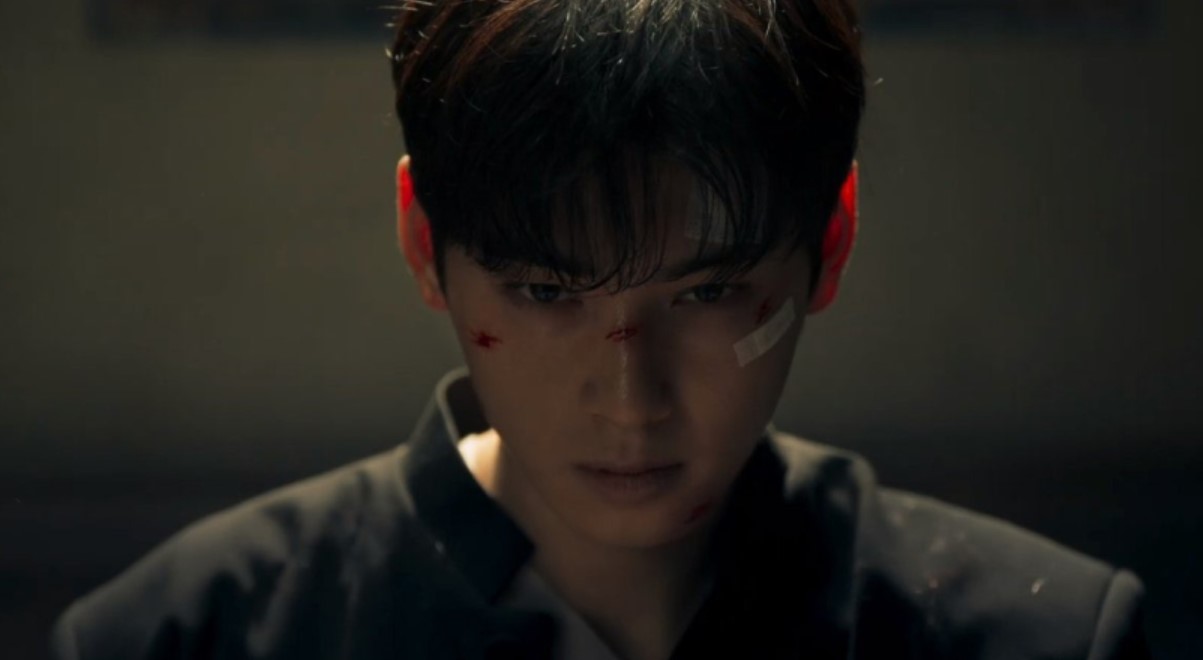 Character from 'Island' drama series with a fierce expression, showing facial injuries and bandages, highlighting a dramatic and intense moment of conflict.